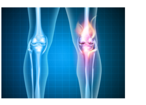 knee joint pain