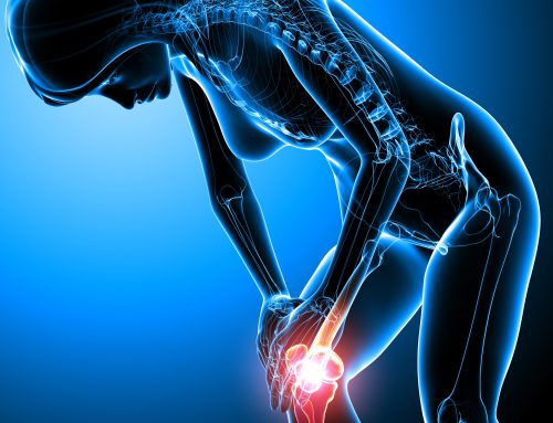 The Dos and Don’ts of Living with Arthritis of the Knee